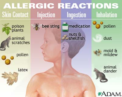 [allergic-reactions-1.jpg]