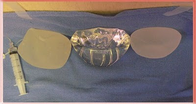 Top view standing upright Saline, Silicone Gel and Cohesive Silicone Gel