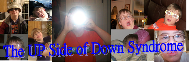 The Up Side of Down Syndrome