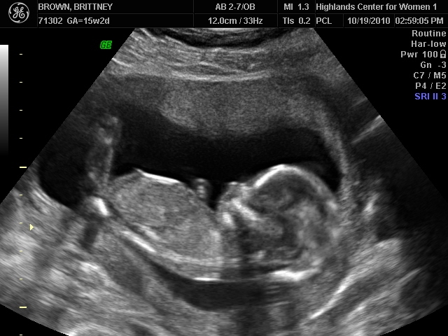 Tanner Wesley Brown 4-10-11: 15 Week Ultrasound