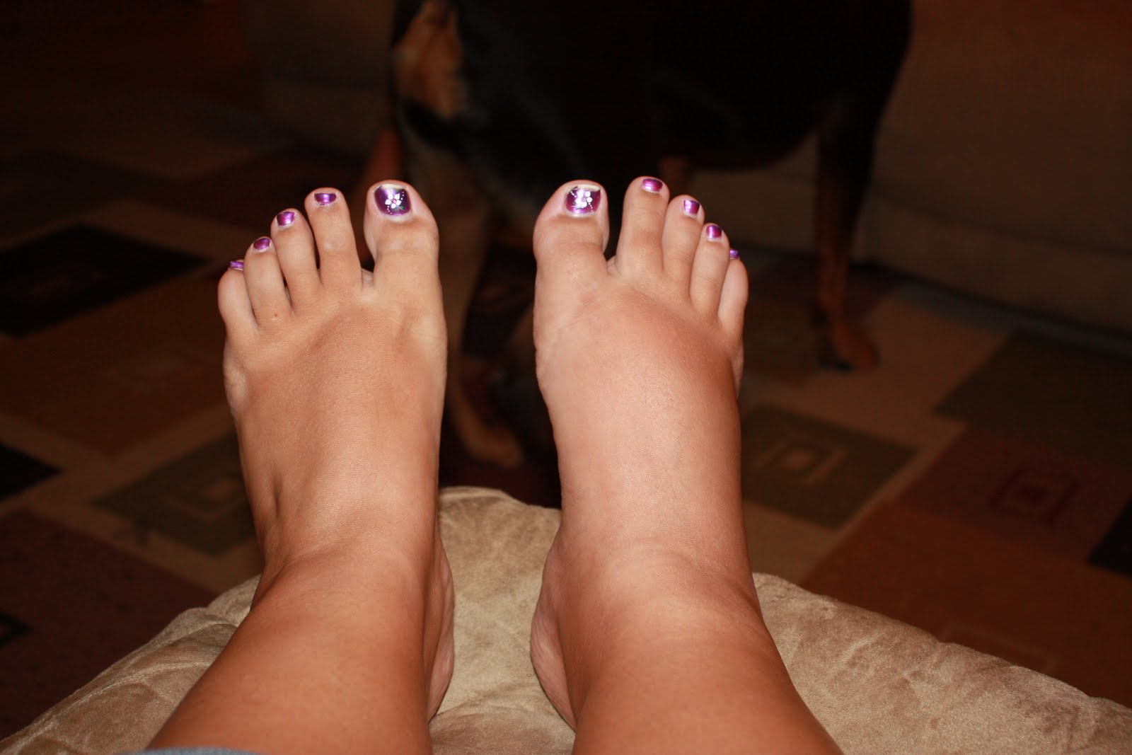 waterlogged-sore-blistered-and-loving-it-ankle-update