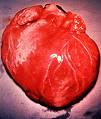 [cardiomegaly1.jpg]