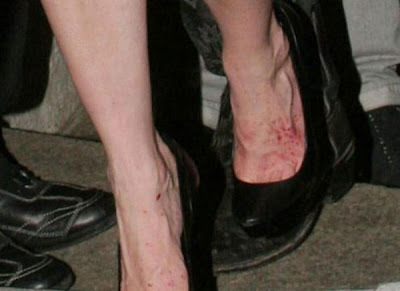 Celebrities With Ugly Feet