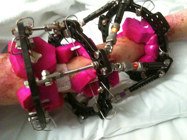 Spacial frame No 3