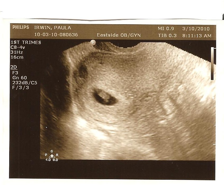 6 week 4d ultrasound pictures 6 week 4d ultrasound pictures