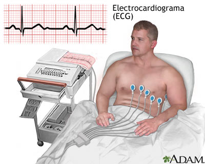 Colocación de electrodos ECG