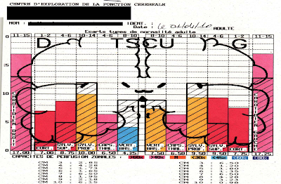 Vive Sana: Peligros Ocultos de Cocinar con Microondas