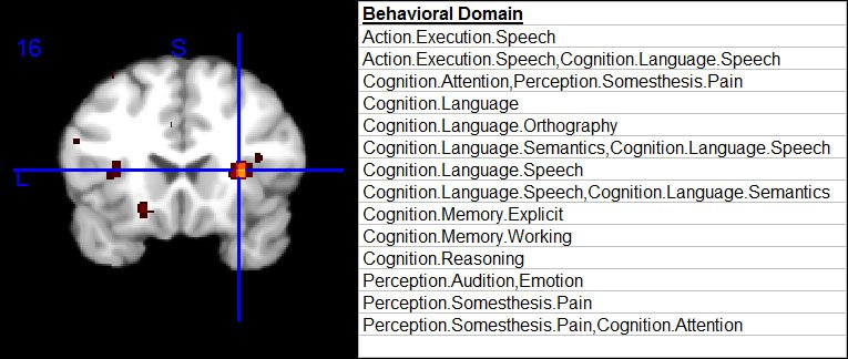 [R+insula+(BrainMap).jpg]