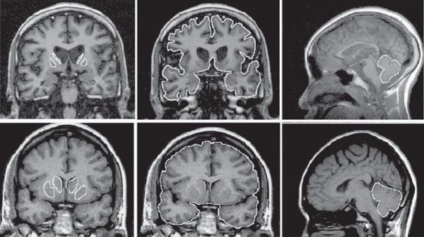 [HD_Ruocco-Fig1.jpg]