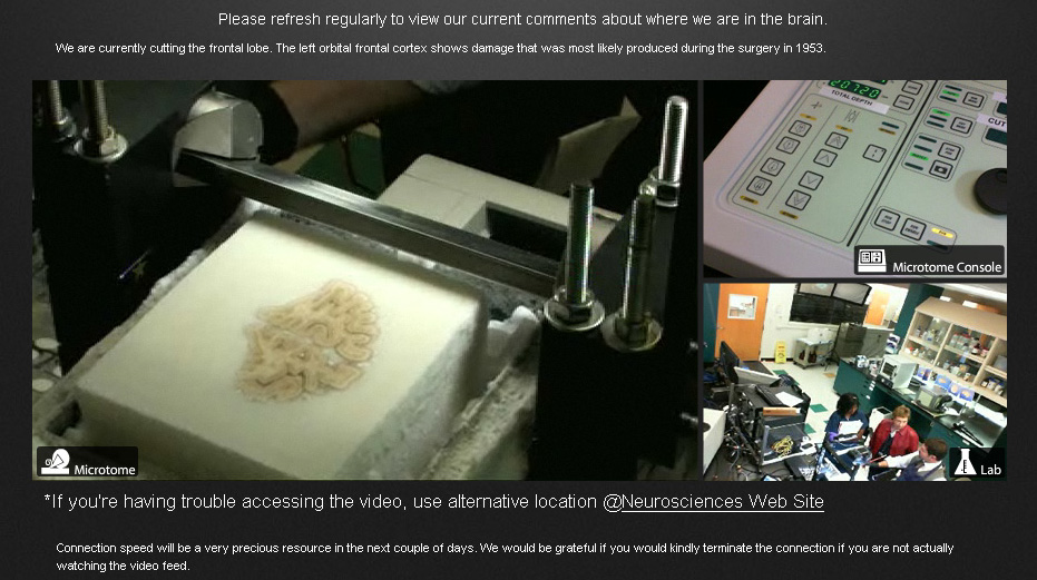 [H.M.+brain+slicing.jpg]