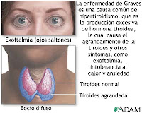 enfermedad visual data 3