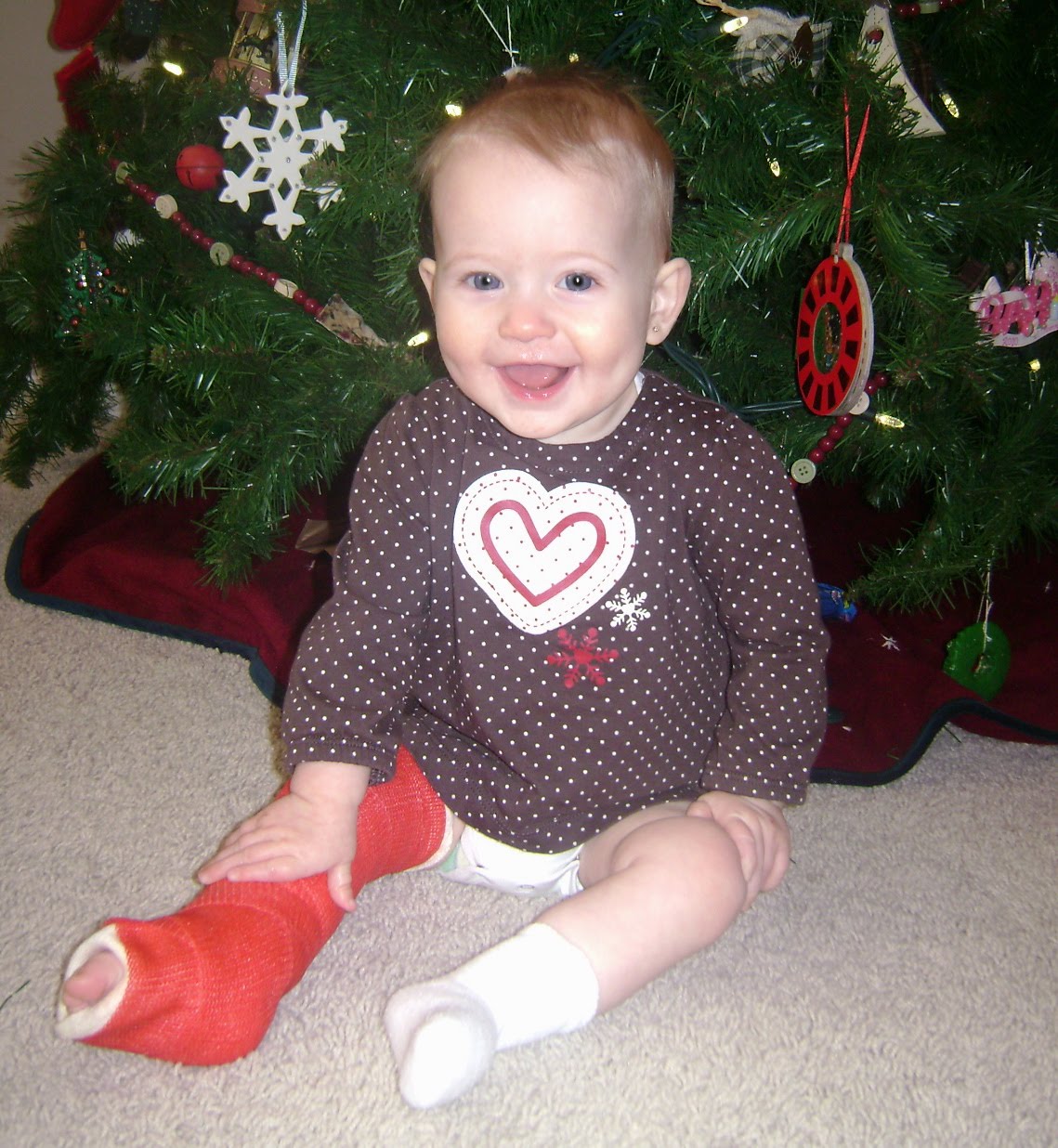 Harker Happenings Sydnee's broken leg