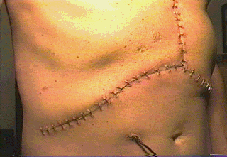 Mercedes scar #5