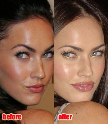 megan fox before and after plastic. megan fox surgery efore after