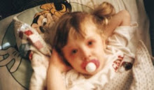 Brooke, diagnosed with KD in 1990