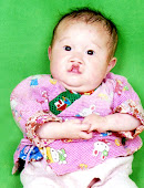 Emerson