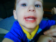 Anthony