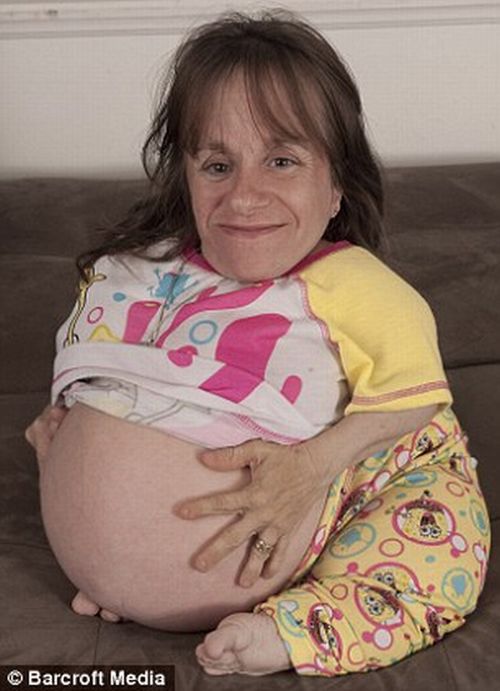 alison brie: World's Smallest Mother Is Pregnant Again