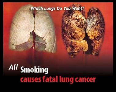 Which Lungs Do You Want?