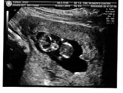 Baby Turek -02/24/09
