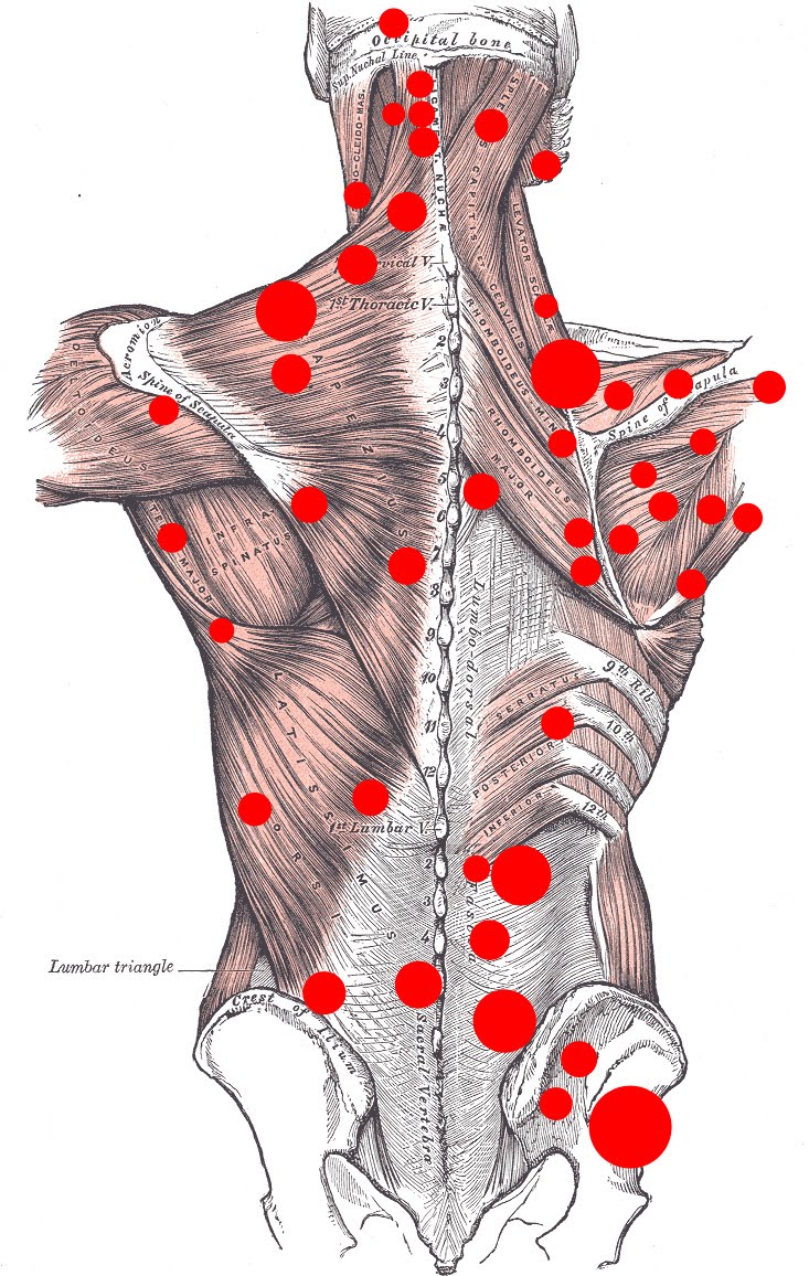 Vital Advice About Easing Your Back Pain 2