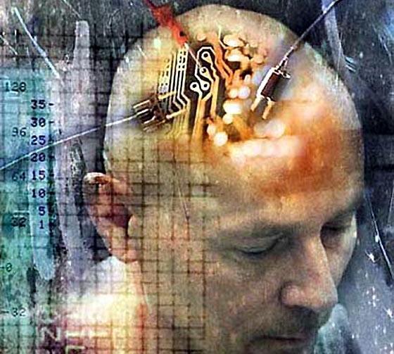 [brain[1].JPG]