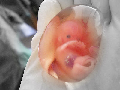 Human Fetus at 10 Weeks - Photo by drsuparna (CC)