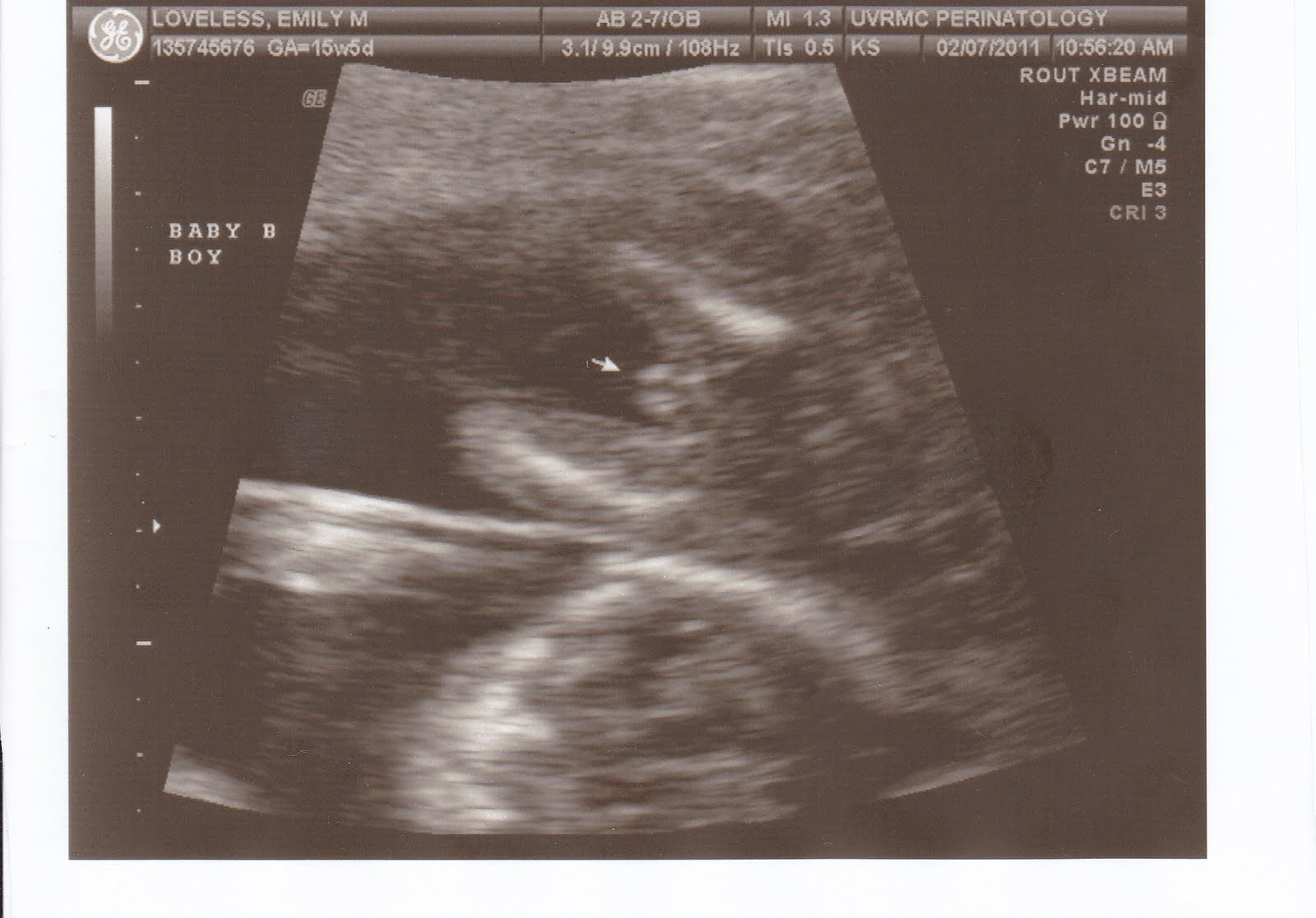 loveless family one boy one girl ultrasound pics at 16 weeks old