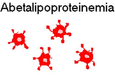 Image result for abetalipoproteinemia