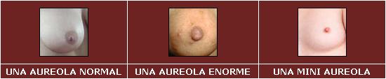 [aureola.JPG]