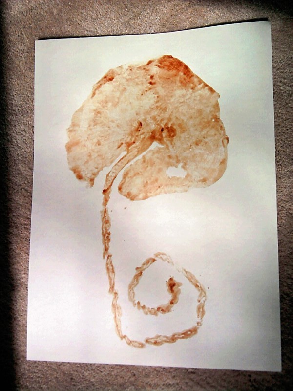 Fruit of the Womb Placenta Prints
