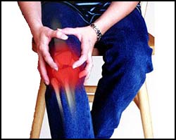 Artritis Infeksiosa : Infeksi Pada Cairan &amp; Jaringan sendi - Terapi