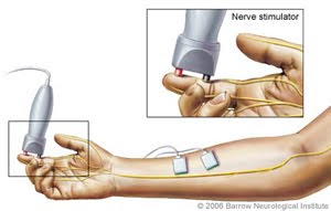 emg test on back emg test on back