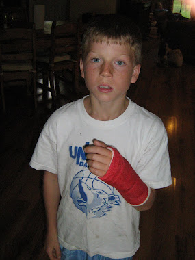 Jonboy's second broken arm