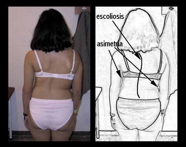 TRIANGULO DE LA TALLA ASIMETRICO