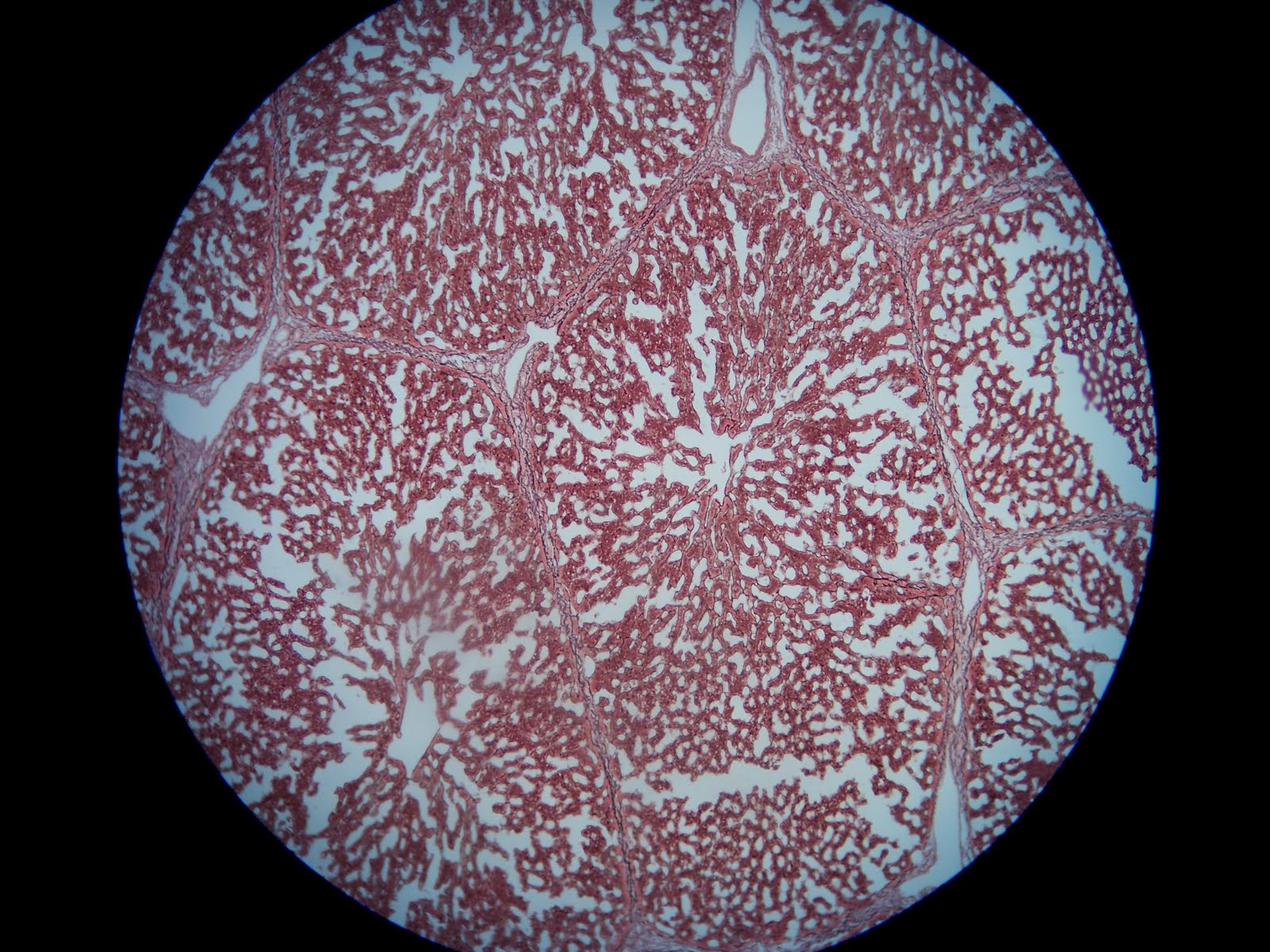 ZAT AL-FUDHUL: Fatty Liver Histology compared to Normal Liver.