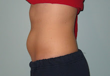 12 weeks (3 months)