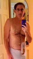 Guy with iPhone and ileostomy bag