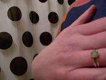 I have this wicked scar on my hand