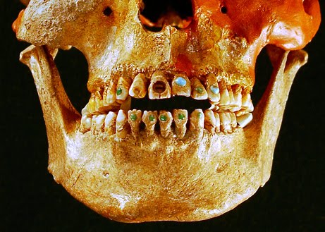 [2009-05-fn-tooth-decoration-skull.jpg]