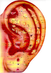 Auriculoterapia