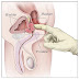 Symptoms of Enlarged Prostate | Natural Remedies for Enlarged Prostate