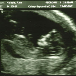 12 Week ultrasound