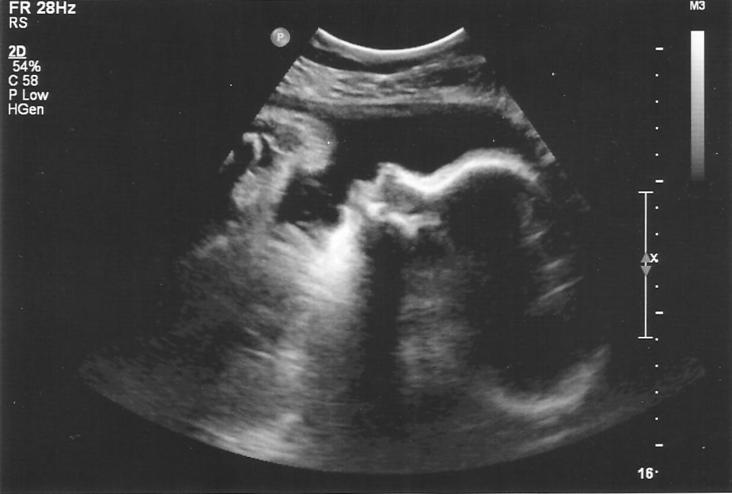 Debabblings 35 week ultrasound and pictures