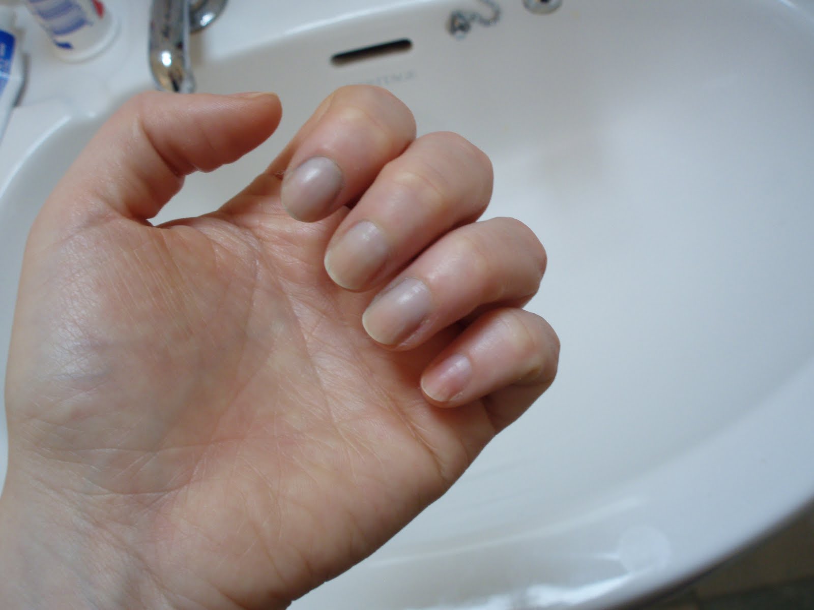 Snowdrop85 Stained Nails? Give This A Go!