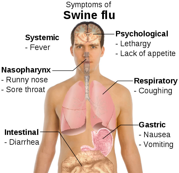 [swine_flu_symptoms_checker.jpg]
