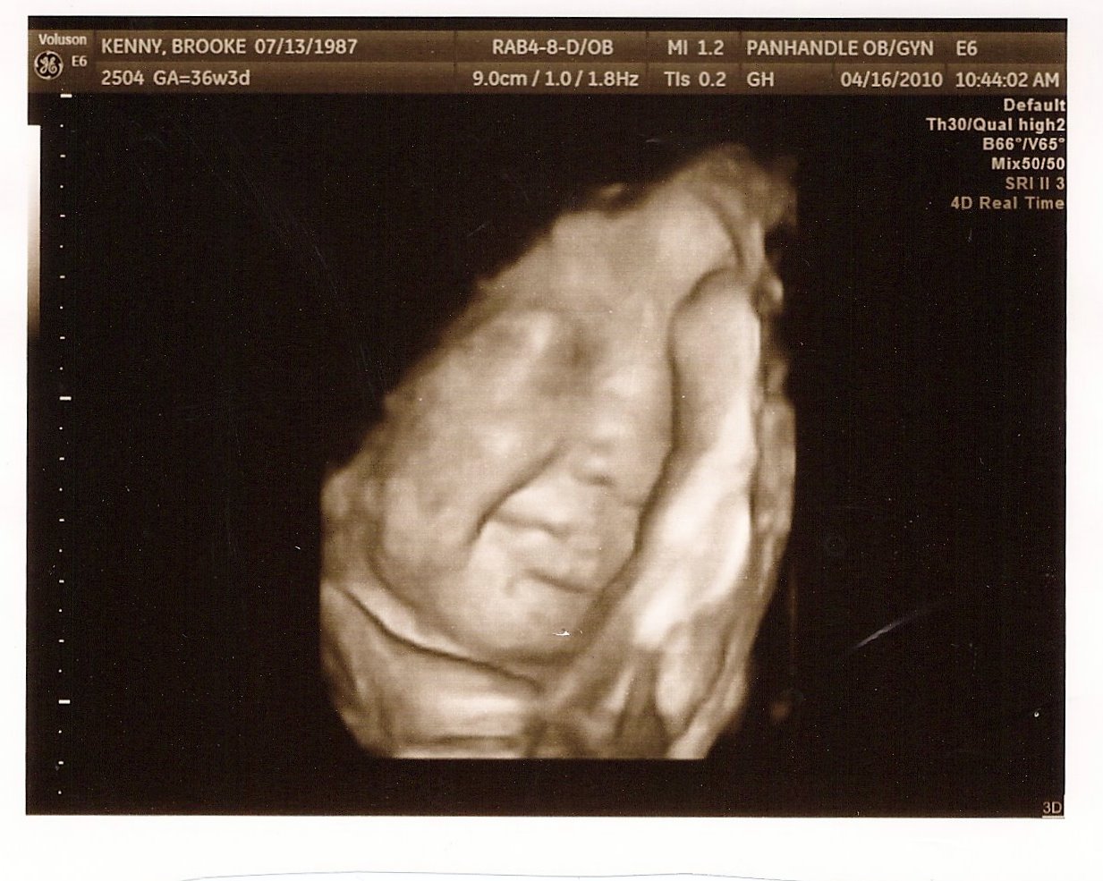 The Kenny Family Ultrasound Pictures 36 weeks