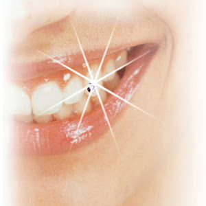 diamond%20smile.jpg