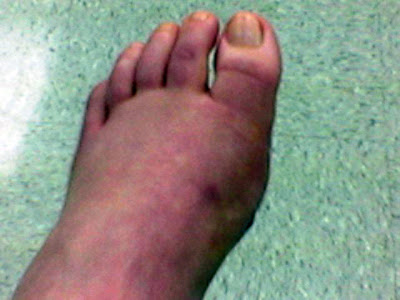 A Series of Unfortunate Podiatric Events. | Grasping for Objectivity