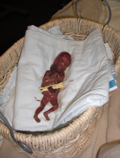 miscarriage-7-weeks-stillbirth-19-weeks-and-hope-for-a-new-life